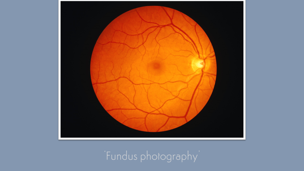 The Kick-About #30 ‘Fundus Photography’